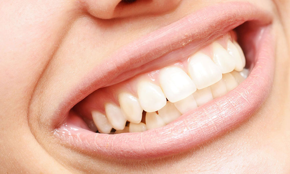 انواع دندان های انسان