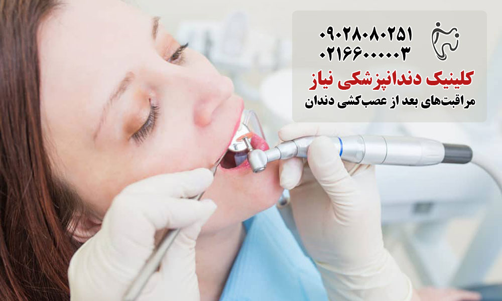 مراقبت‌های بعد از عصب‌کشی دندان