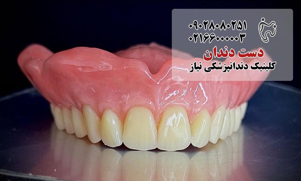 مراقبت از دست دندان