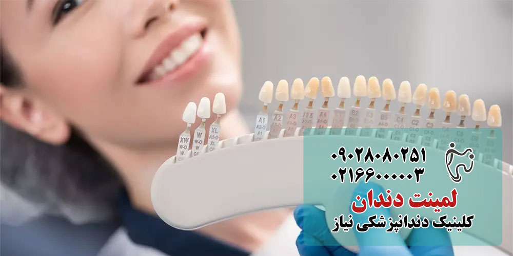 لمینت دندان در کلینیک دندانپزشکی نیاز