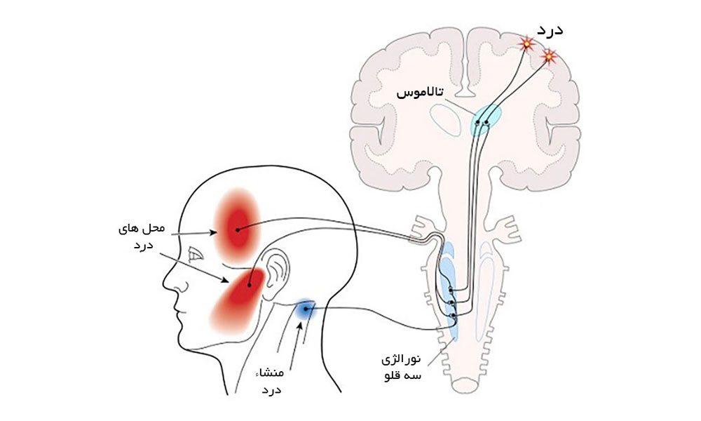 تشخیص دندان درد ارجاعی