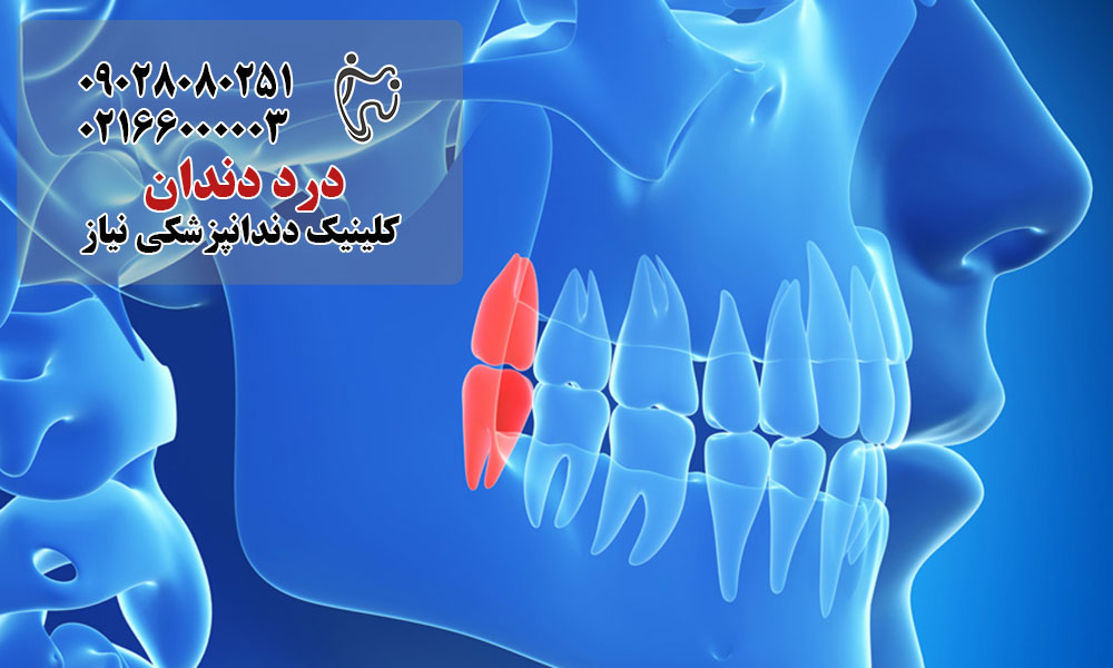 علل دندان درد ارجاعی