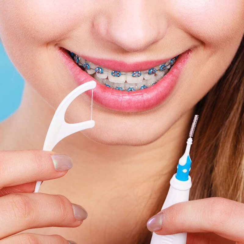 نکات و ترفندهای کلی برای نخ دندان کشیدن با بریس