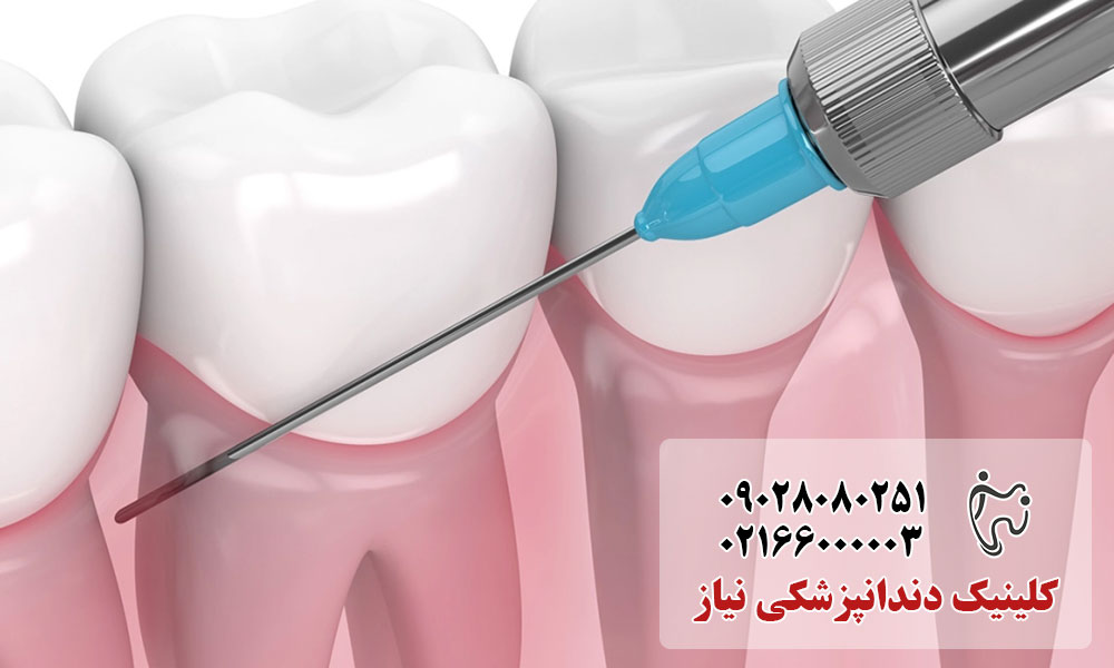 انواع بی حسی موضعی