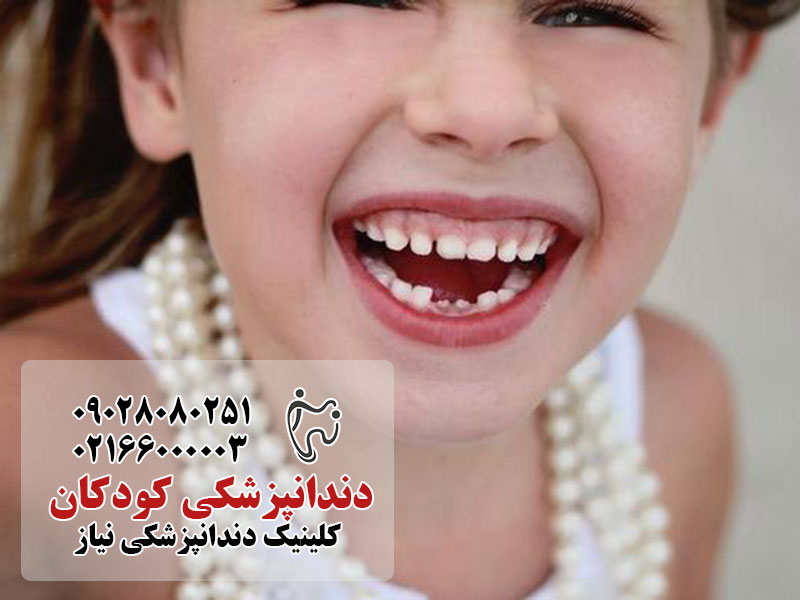 علل زردی دندان کودکان