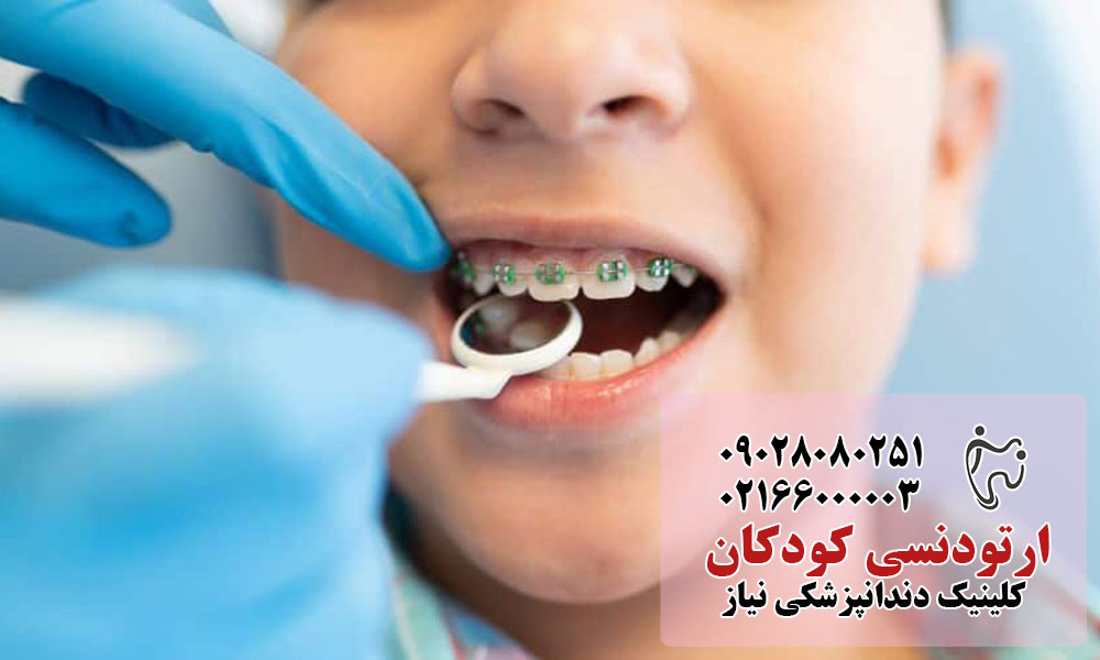ارتودنسی کودکان