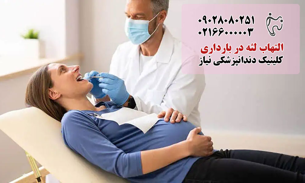 التهاب لثه در بارداری چیست؟