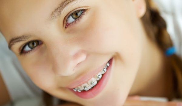 بهترین سن برای شروع ارتودنسی