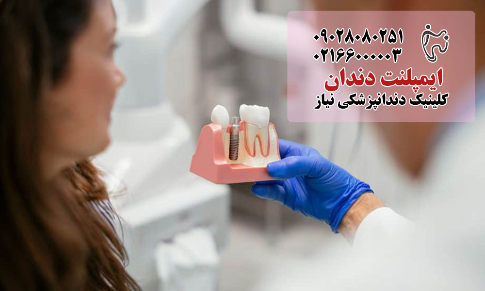 تعویق انداختن ایمپلنت در دوران بارداری