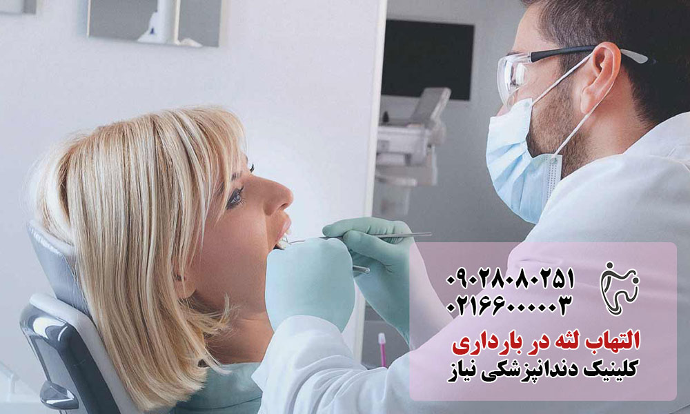 درمان التهاب لثه بارداری