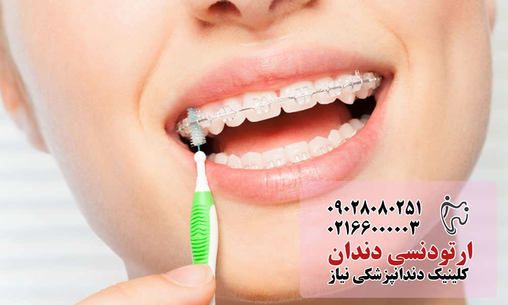 درمان پوسیدگی دندان با ارتودنسی