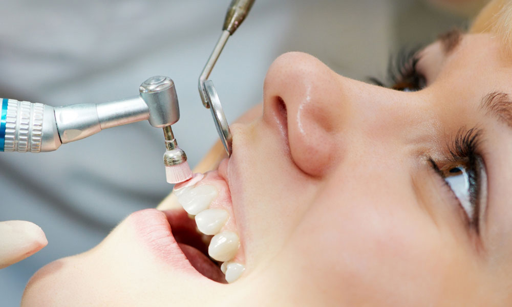 میکروابریژن