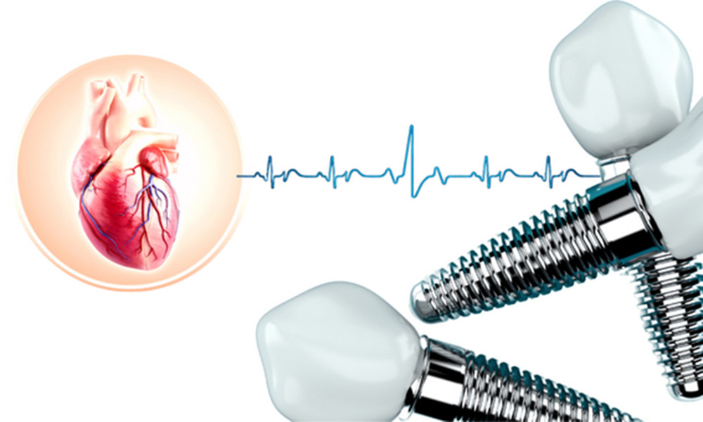 آیا ایمپلنت دندان برای بیماران قلبی خطر دارد؟