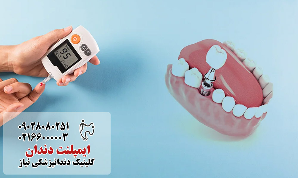 جراحی ایمپلنت برای بیماران دیابتی