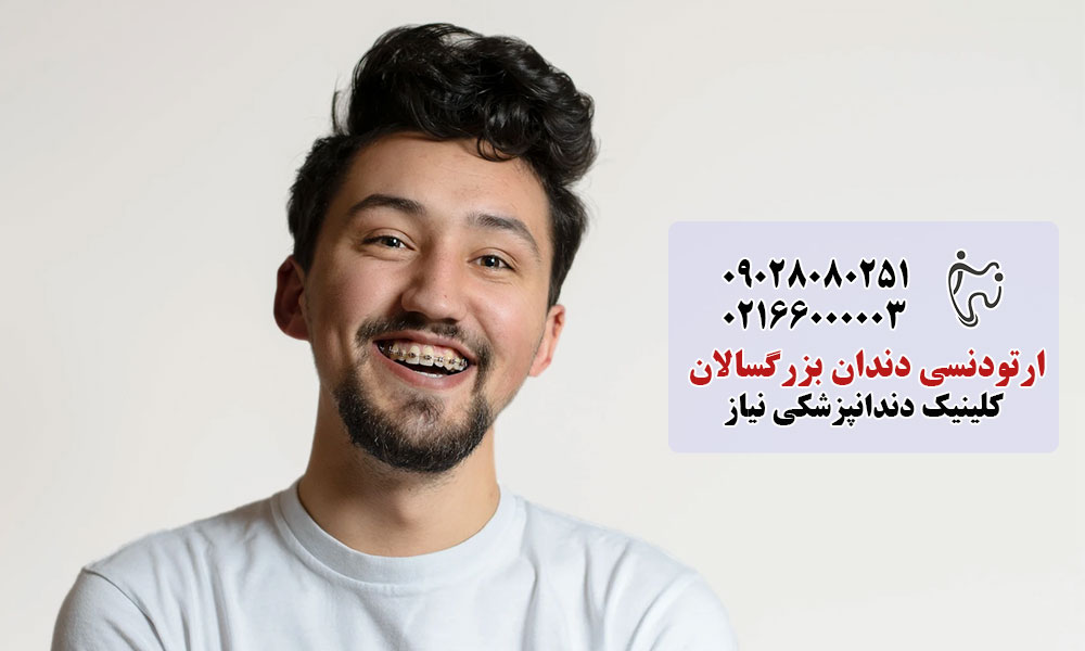 شرایط ارتودنسی دندان در بزرگسالان
