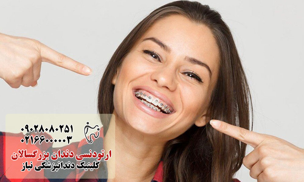 مزایای ارتودنسی بزرگسالان