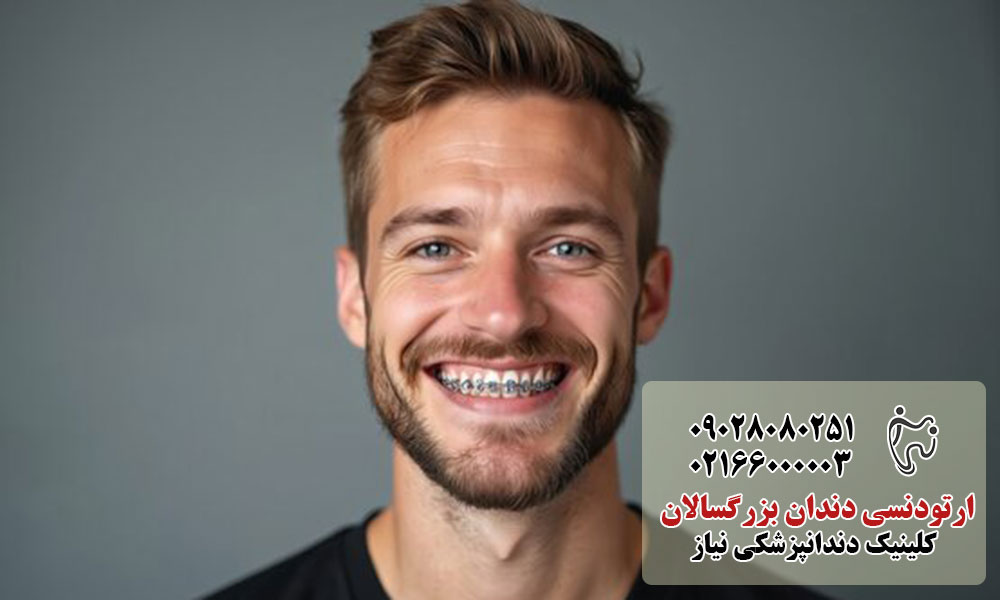 مزایای ارتودنسی بزرگسالی