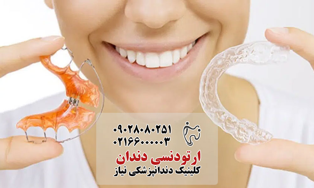 مقایسه ارتودنسی ثابت و متحرک