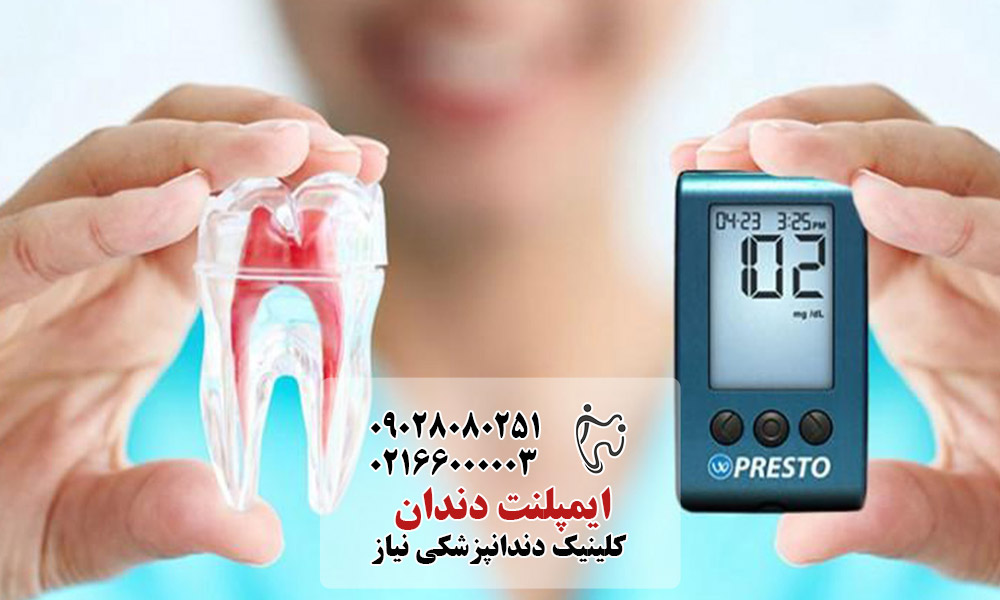 کاشت ایمپلنت در بیماران دیابتی
