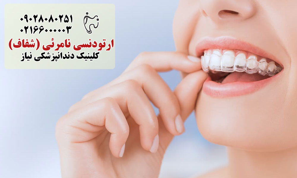 مراحل درمان ارتودنسی نامرئی