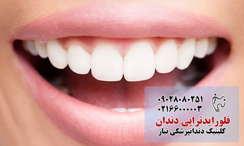 اهمیت فلورایدتراپی
