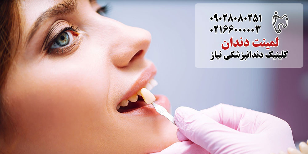 مراقبت از لثه‌ بعد از لمینت دندان