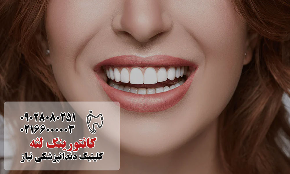 مراقبت‌های ضروری بعد از کانتورینگ لثه