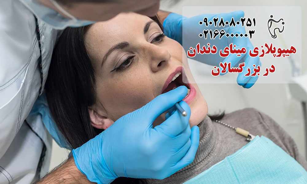 هیپوپلازی مینای دندان در بزرگسالان