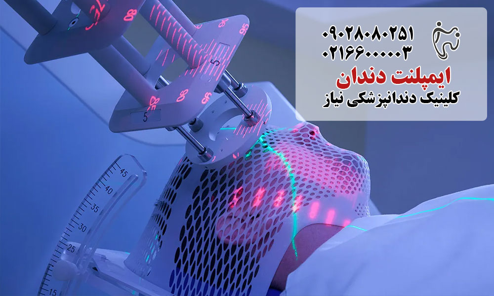 تاثیر رادیوتراپی شیمی درمانی بر دندان